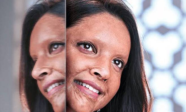'ആ പേര് ഉള്പ്പെടുത്തുന്നതില് എന്തിനാണ് മടി?' ദീപിക ചിത്രം ഛപാക്കിനെതിരെ ഡല്ഹി ഹൈക്കോടതി