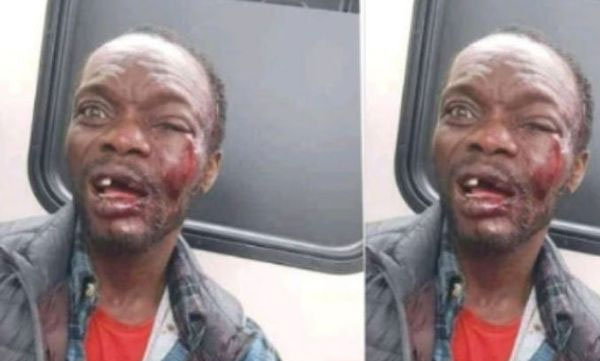 crowd beaten preacher after condoms fall from bible