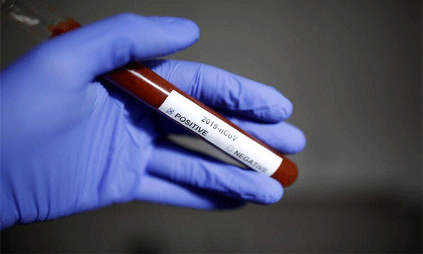 footballer lee defi affected corona virus