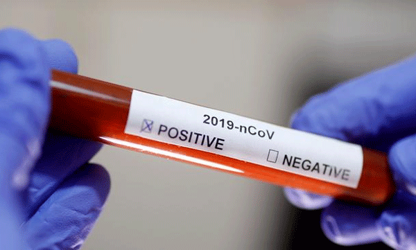 corona medicine, transfer of covid 19 antibodies into critically ill patients