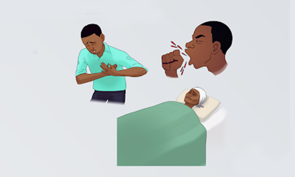 tb symptoms and treatment