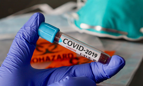 karipur airport staff confirmed covid 