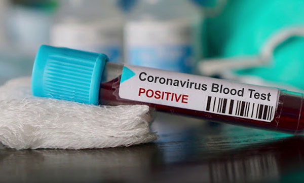 alappuzha 11 people from same family confirmed with covid 