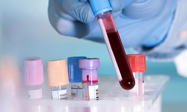 five year old kid wants rare blood group 