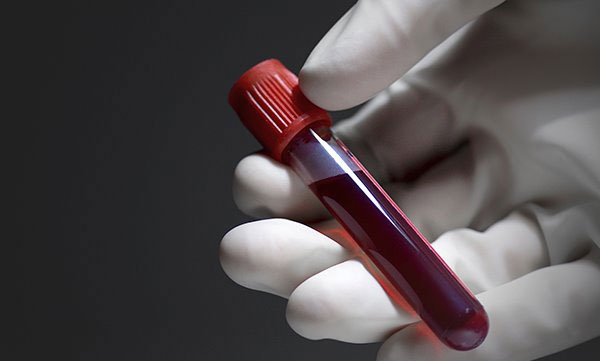 get p null blood for child