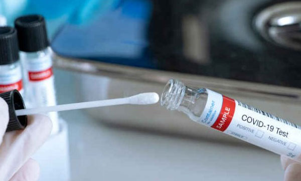 arikkadi natives not ready for antigen test