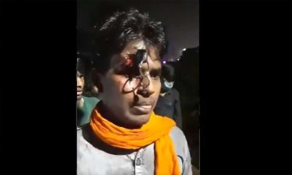 for not wearing helmet police stab mans forehead with key 