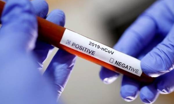 four employees confirmed with covid in guruvayoor coorporation closed 