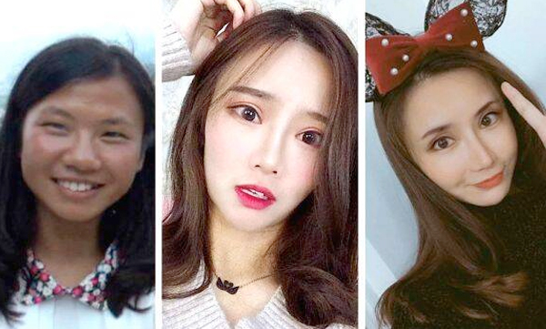 plastic surgery 