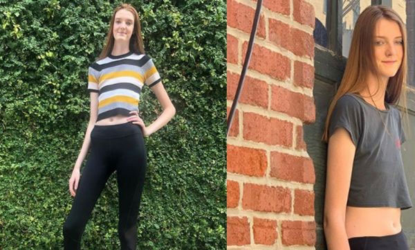 breaks guinness world records for longest legs