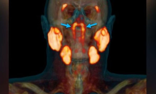 discovered new organ in the human body