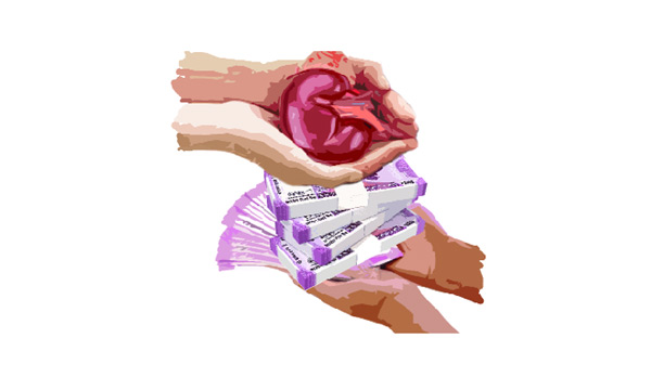 organ transplantation