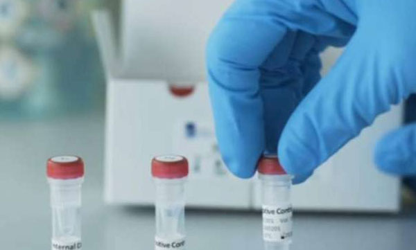 covid and brain health