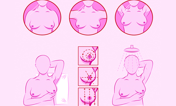 breast cancer symptoms diagnosis and treatment