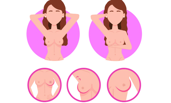 breast cancer symptoms diagnosis and treatment