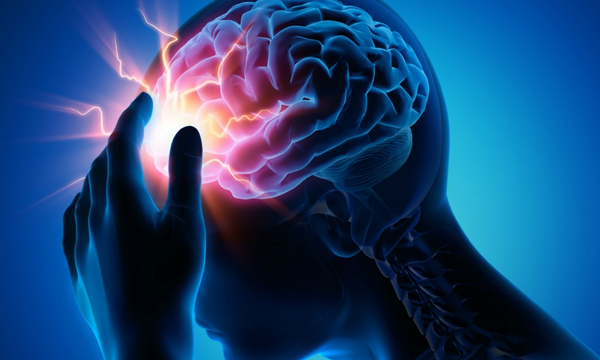 migraine symptoms treatment