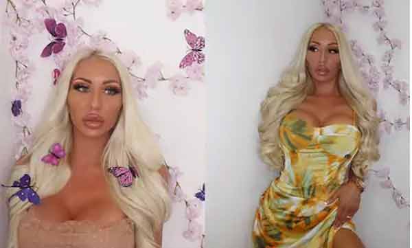 husband spends 17k pound on wife's plastic surgery