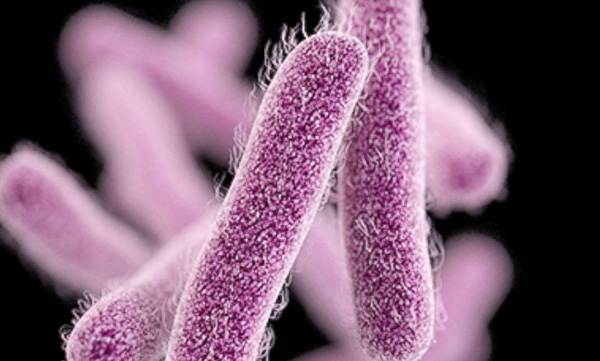 special health team for prob over shigella