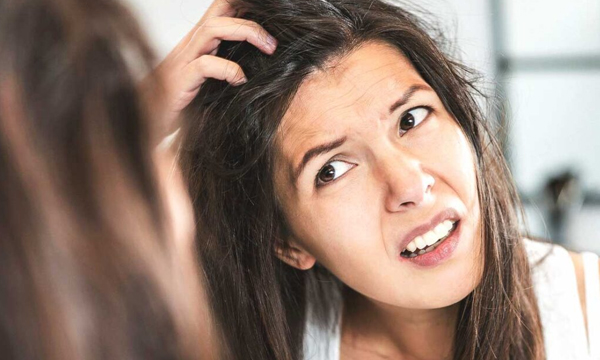 dandruff ayurvedic treatment