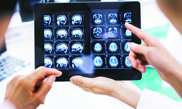 Neurological Problem Symptoms, Causes and Effects