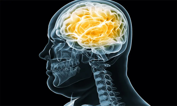 overweight memory loss