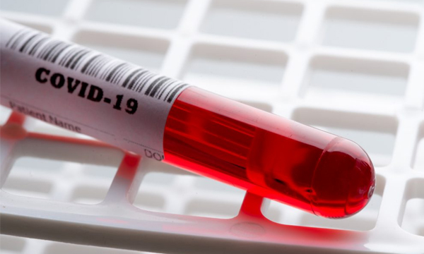 COVID-19 and diabetes