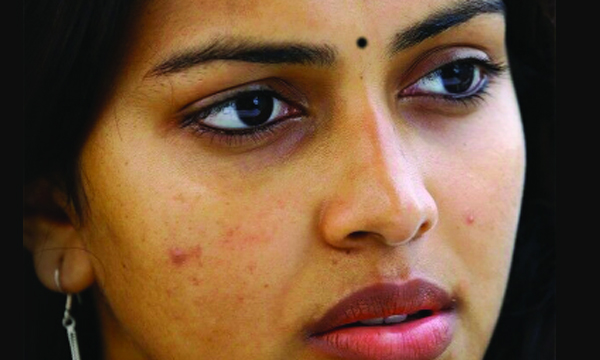 pimples on face removal tips