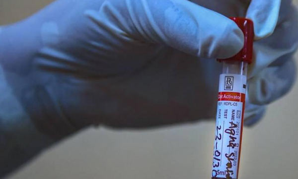 New guidelines for Covid treatment