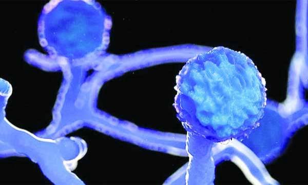 Black Fungus Cases Grow 150% In 3 Weeks To 31,000