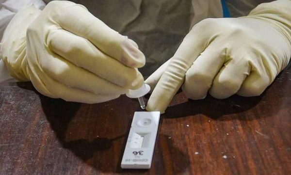 Antibody cocktail experiment 