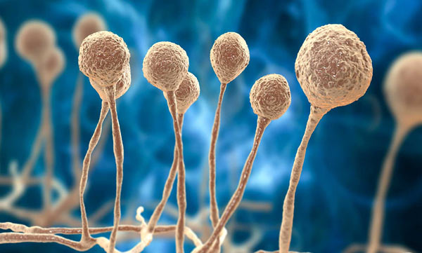 Eyes Of 3 Children Infected With Black Fungus Removed In Mumbai