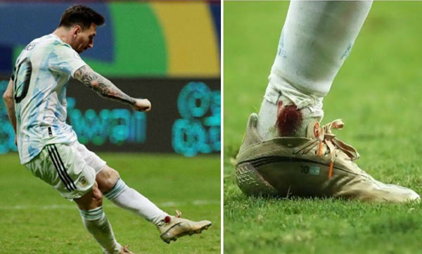 Copa America 2021: Lionel Messi plays on with a bleeding ankle against Colombia in semis