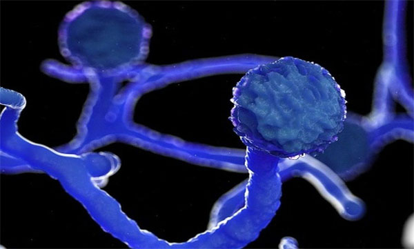 Mucormycosis Kills 303 in Karnataka 