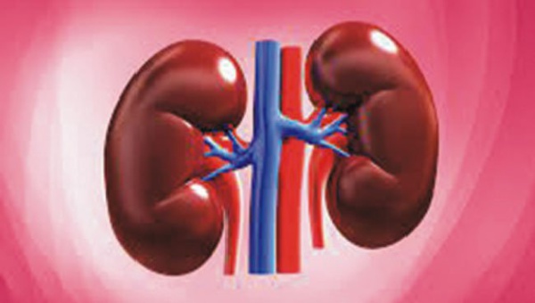Kidney transplant 