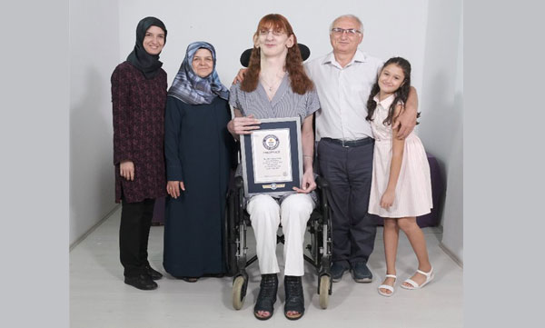 Rumeysa Gelgi- Guinness World Records title holder for the tallest living woman.