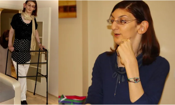 Rumeysa Gelgi- Guinness World Records title holder for the tallest living woman.