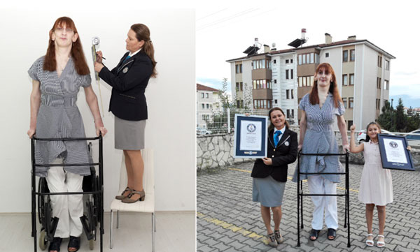 Rumeysa Gelgi- Guinness World Records title holder for the tallest living woman.