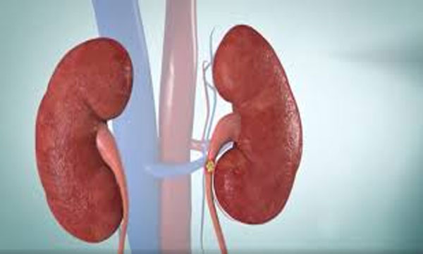 Doctor removed kidney instead of stone; fined 11,23 lakh