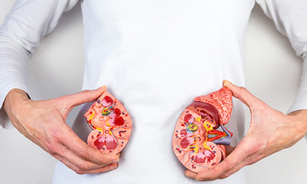 kidney stone symptoms and treatment