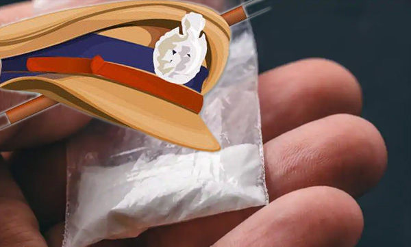 drug-use-is-not-a-crime-central-government-plans-to-amend-the-law