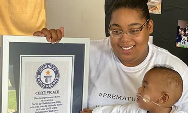 world-s-most-premature-baby-to-survive-guinnes-world-record-for-alabama-baby-curtis