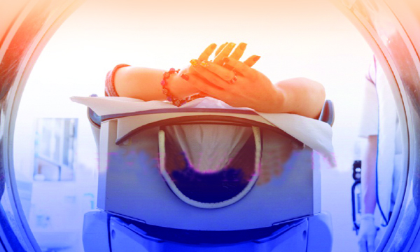 breast cancer radiation treatment