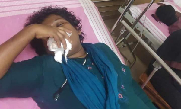 bindu-ammini-says-sangh-parivar-was-behind-the-assassination-attempt