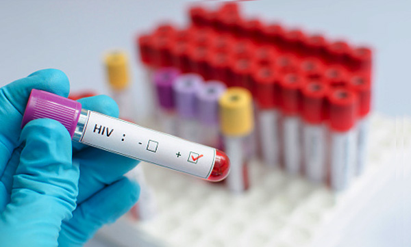 first-woman-reported-cured-of-hiv-after-stem-cell-transplant