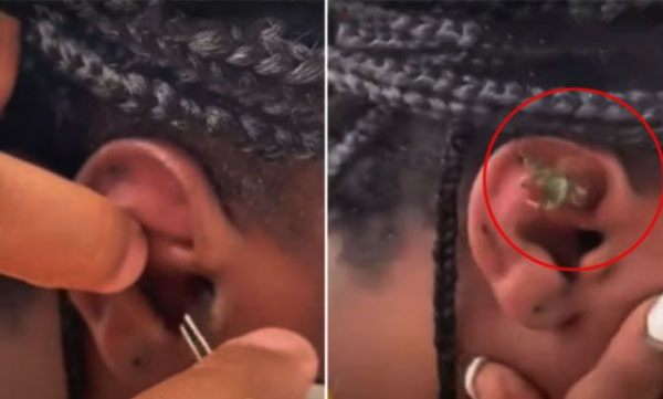 crab-gets-stuck-in-womans-ear-while-snorkelling