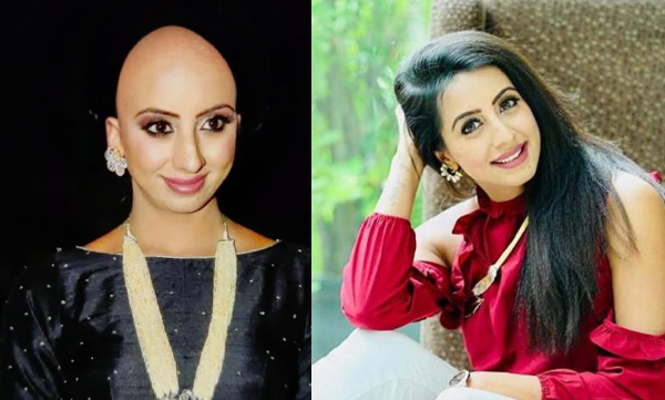 Sanjana Galrani donated her hair, fans became surprised