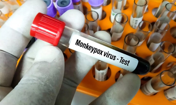 who-says-monkey-pox-has-chance-to-increase-in-the-coming-days