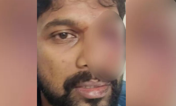 youth-congress-left-eyesight