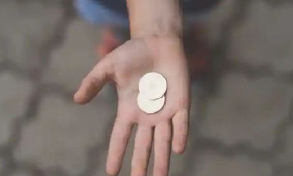 boy-sneezes-coin-that-stucked-inside-his-nose-before-ten-years