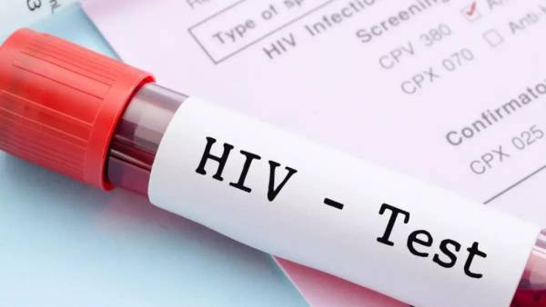 4,000 people infected with HIV across world every day: UN